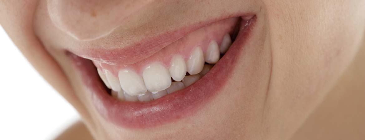 Schöne Zähne in Salzkotten: Vollkeramik, Bleaching, Veneers
